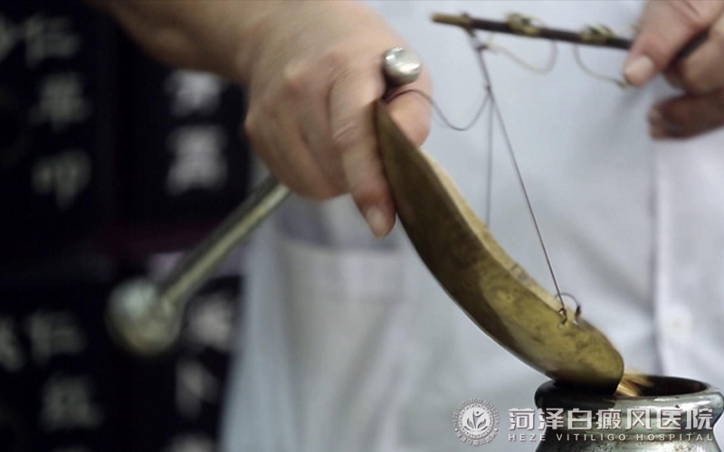 白癜风专科(kē)医院山(shān)东